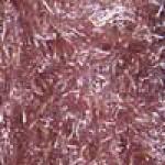 Dusty Rose Dozen Pack